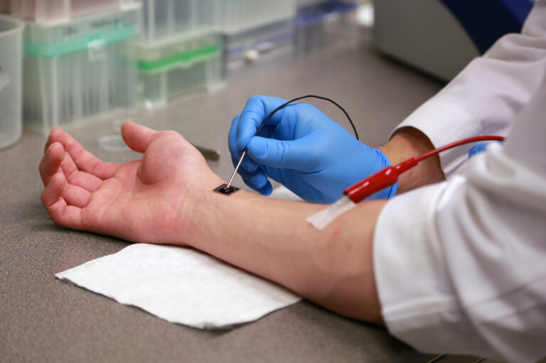 Revolutionary Tissue Nanotransfection Chip: The Future of Regenerative Medicine and Stem Cell Technology
